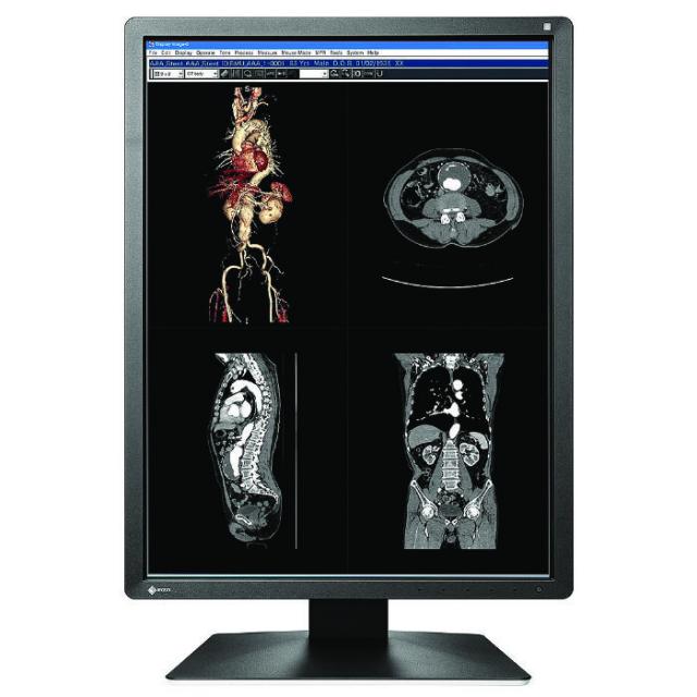Medical Monitor EIZO RadiForce MX216-HB 2MP, Color 