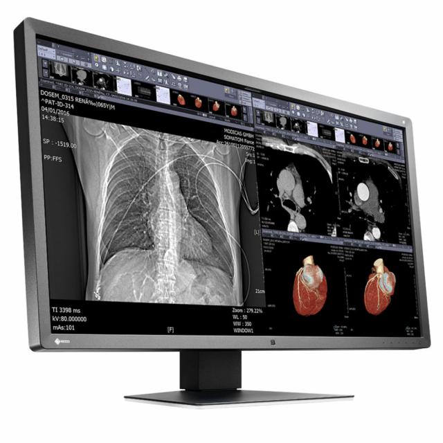 Medical Monitor EIZO RadiForce MX315W 8MP Цветен 