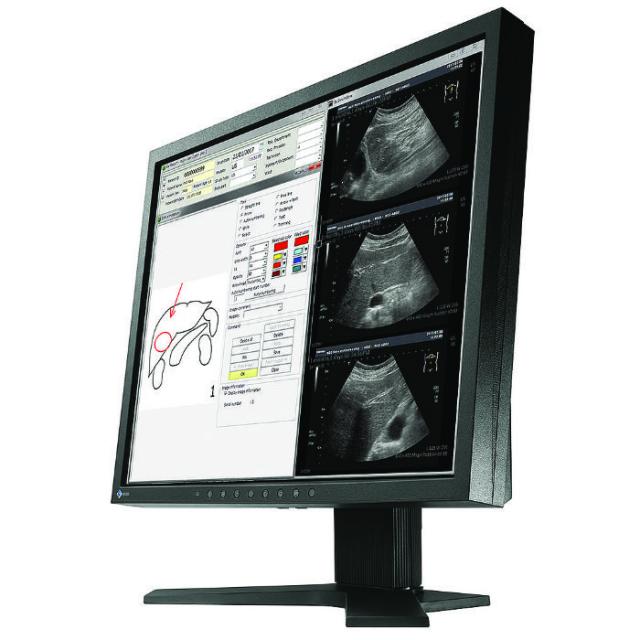 Medical Monitor EIZO RadiForce MX194 1MP Цветен 