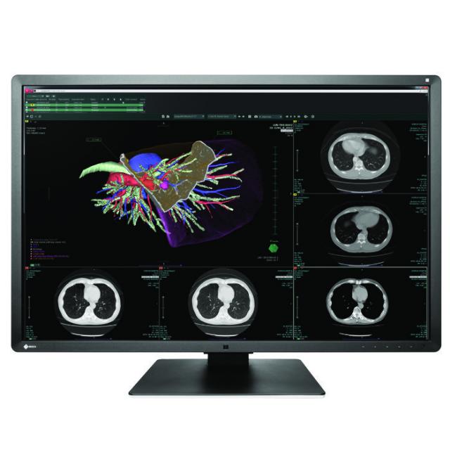 Medical Monitor EIZO RadiForce RX660 6MP Цветен 