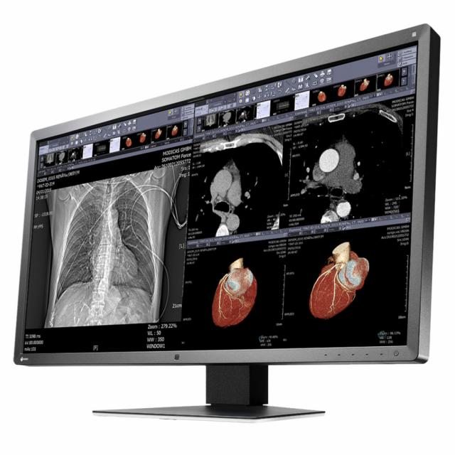 Medical Monitor EIZO RadiForce MX315W 8MP Цветен 