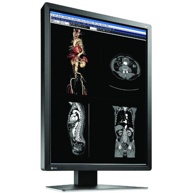 Medical Monitor EIZO RadiForce MX216-SB 2MP Цветен 