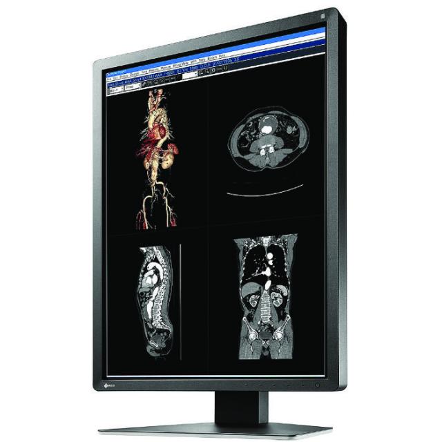 Медицински монитор EIZO RadiForce MX216-HB 2MP Цветен 