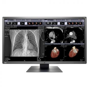 Medical Monitor EIZO RadiForce MX315W 8MP Цветен