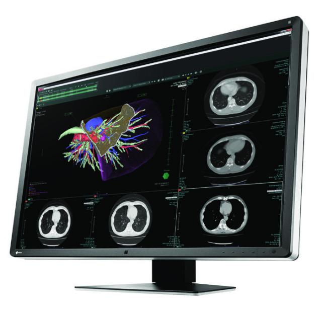 Медицински монитор EIZO RadiForce RX660 6MP Цветен 