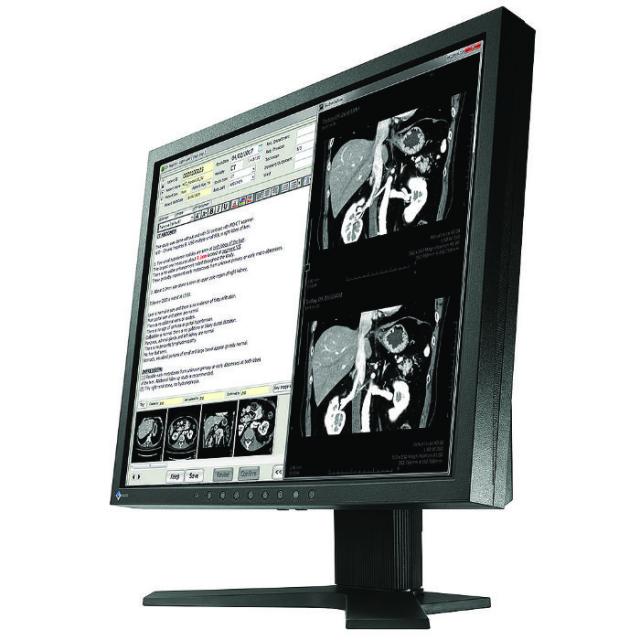 Medical Monitor EIZO RadiForce MX194 1MP Цветен 