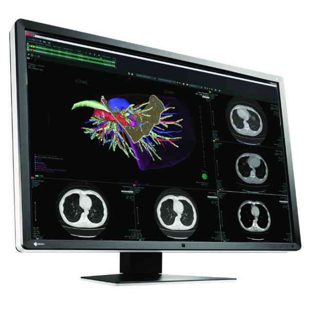 Медицински монитор EIZO RadiForce RX660 6MP Цветен 