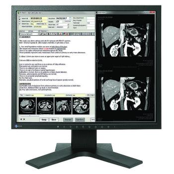 Medical Monitor EIZO RadiForce MX194 1MP Цветен