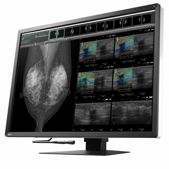 Medical Monitor EIZO RadiForce RX1270 8MP Цветен 