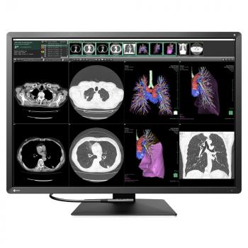 Medical Monitor EIZO RadiForce RX1270 8MP Цветен