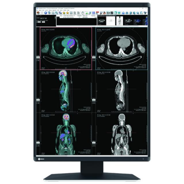 Medical Monitor EIZO RadiForce RX560 5MP, Color 