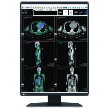 Medical Monitor EIZO RadiForce RX370 3MP, Color