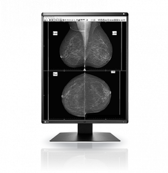 Medical Monitor EIZO RadiForce GX560 5MP Монохромен