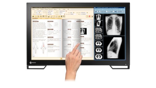 Медицински монитор EIZO RadiForce MS236WT 2MP Цветен, Тъч 