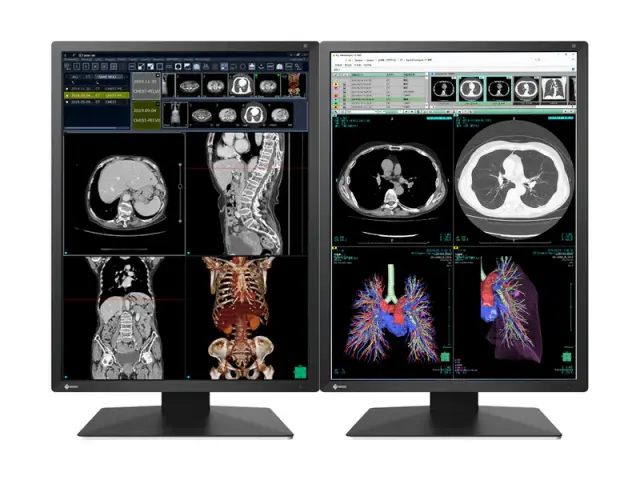 Medical Monitor EIZO Radi Force RX270 - 21.3" inch, 2MP Color LED 