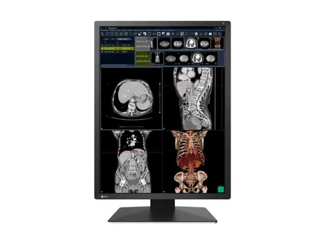 Medical Monitor EIZO Radi Force RX270 - 21.3" inch, 2MP Color LED 